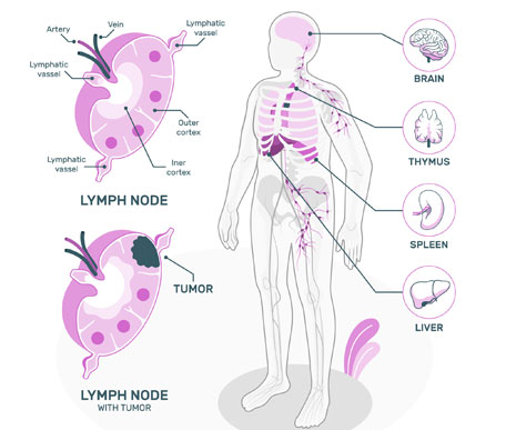 
                      Lymphomas & Myeloma
                  