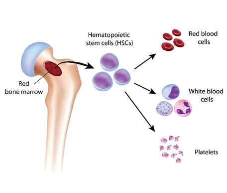 Myelodysplastic & Myeloproliferative Neoplasms