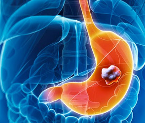 
                      
                      
                      
                      what is hematology oncology doctor
                  
                  
                  
                  