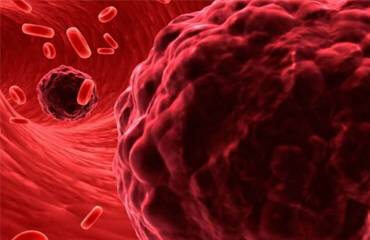 hematology oncology doctors 